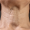 dermafocus feature image correct (75)