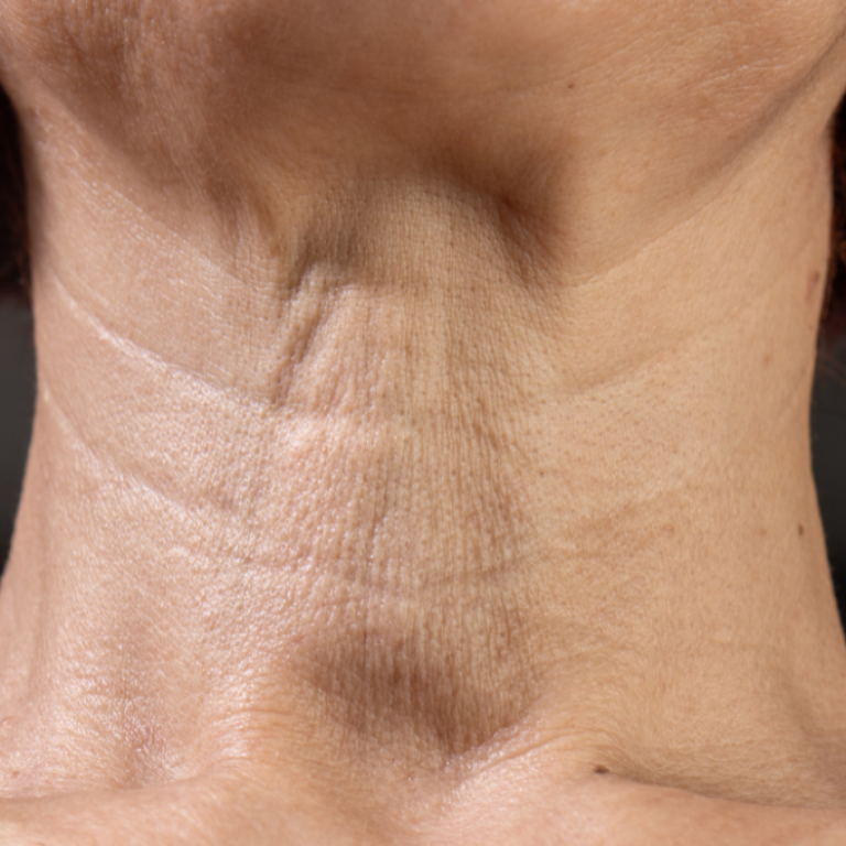 dermafocus feature image correct (75)