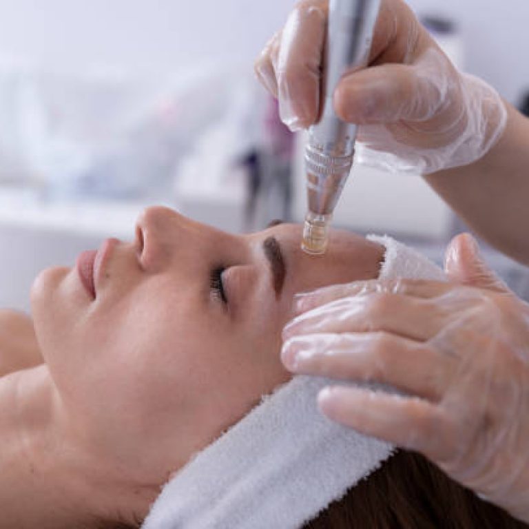 close up of Cosmetologist,beautician applying facial dermapen treatment on face of young woman customer in beauty salon.Cosmetology and professional skin care, face rejuvenation.